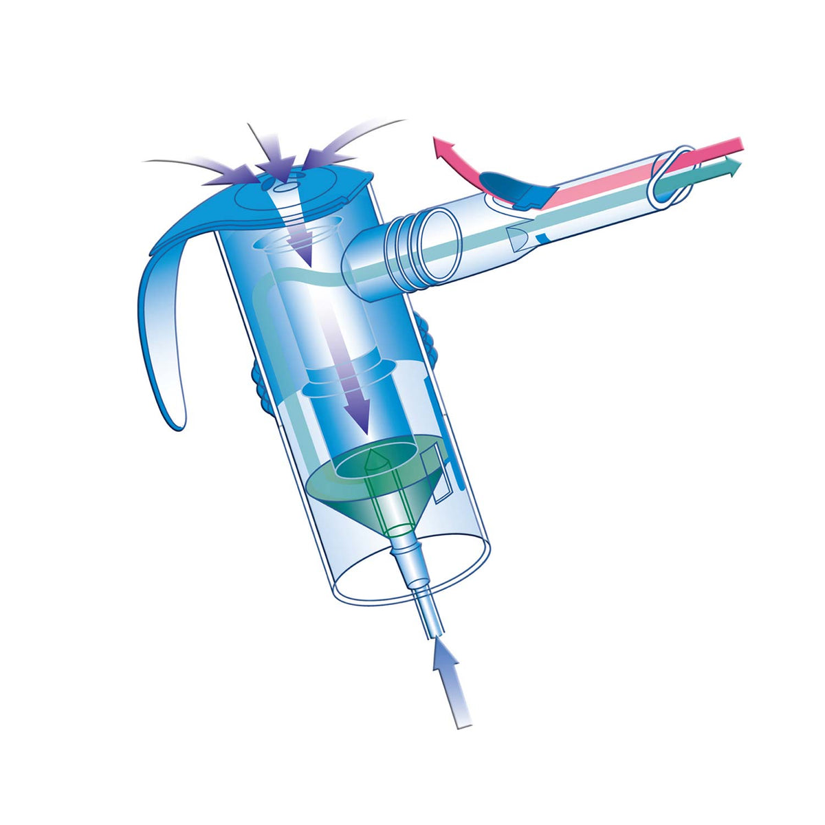 PARI LC Reusable Nebulizer Set - Buy 5 and Save $5 - Nebulizer technology